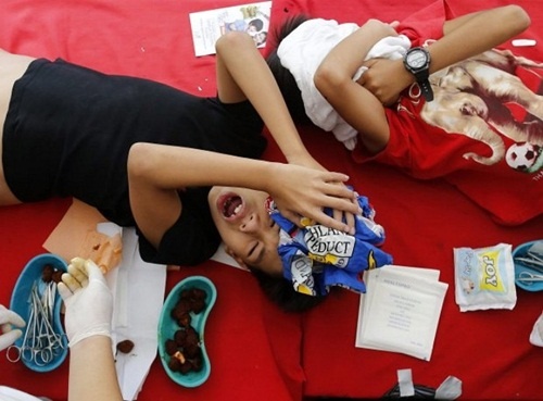 タリーの手術中　フィリピン