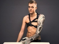 電車事故で片手を失ったゲーマー男性、コナミ社が開発したメタルギアソリッドのスネークをモチーフにした多機能バイオニックアームである意味サイボーグ化