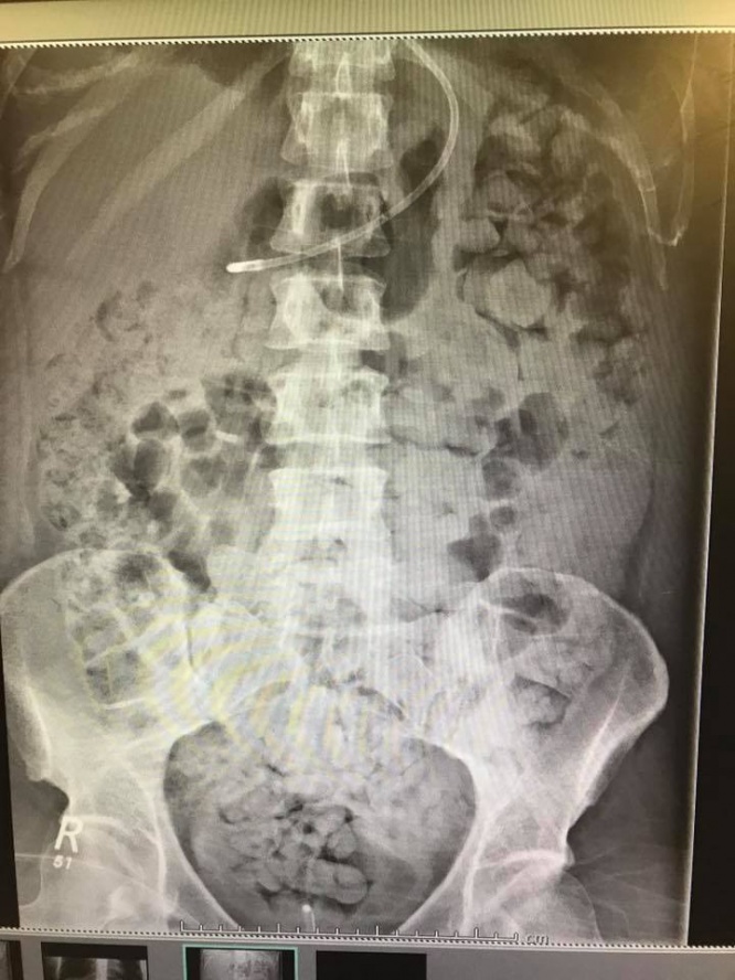 ケリー・ヨモン レントゲン