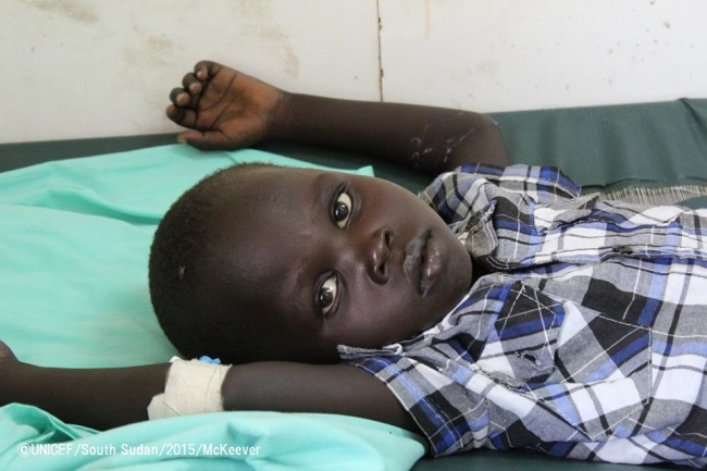 コレラに感染し、重度の脱水症状に陥っていた5歳の男の子。現在は治療を受け、回復に向かっている。©UNICEF South Sudan_2015_McKeever