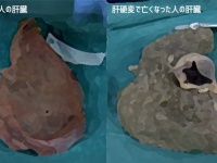 アルコールが肝臓にもたらす影響が一目でわかるショッキングな肝臓比較動画