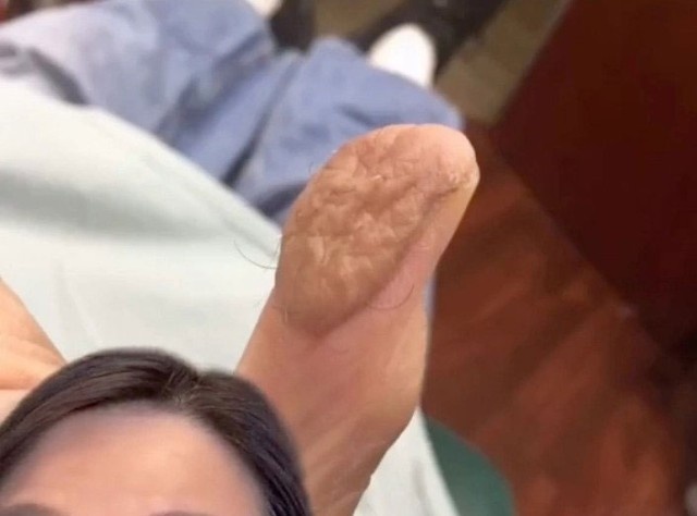 5_e