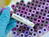 アメリカで未認可の新型コロナ抗体検査が販売が認められている理由