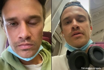飛行機内で子供の叫び声に29時間耐え続けた男性、左目がけいれんしてしまう