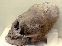 ペルーで発見された長く変形した頭蓋骨は「人工頭蓋変形」ではなく先天的な遺伝子異常によるもの。最新のDNA検査結果が発表される。
