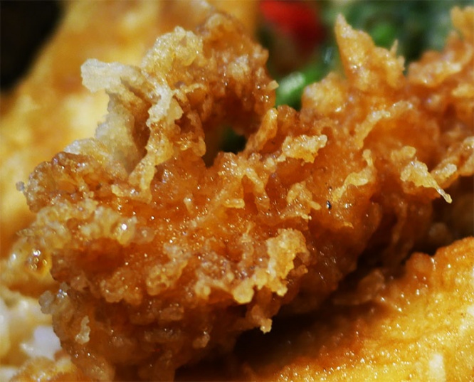 tendon4