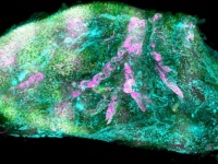 人間の内臓を完全に透明にすることに成功（ドイツ研究）