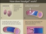 男性用避妊薬がついに誕生！　コレをアソコに注射で…！？