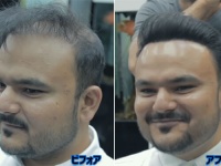 驚愕のビフォア・アフター。増毛繊維パウダー+美容師のテクニックで薄毛が自然なヘアスタイルに大変身