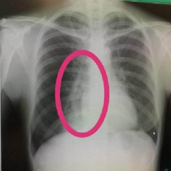 写真はイメージ