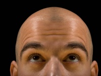 また髪の話をしよう。ニューヨークでハゲを祝うハゲフェスが開催予定