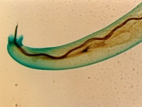 ハワイで人間の脳に侵入する寄生虫の感染者を確認。保健局が注意喚起