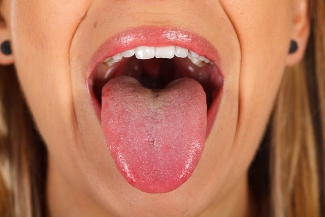 新型コロナのあまり知られていない症状、舌の上や口の中を要チェック（英疫学者）