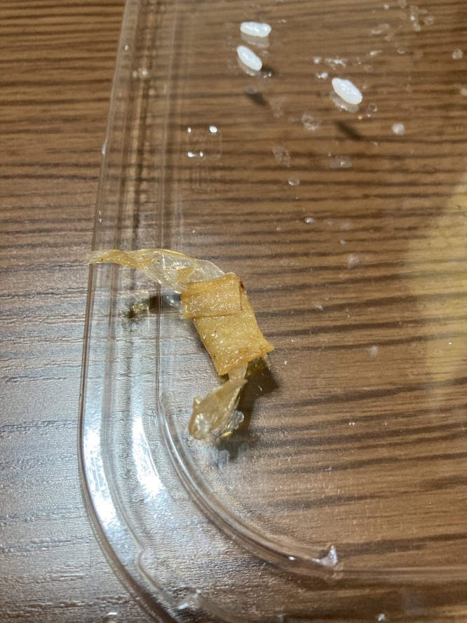大戸屋　唐揚げに絆創膏