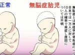 【漫画】脳が無い赤ん坊…それでも産んだ夫婦の話【感動実話】